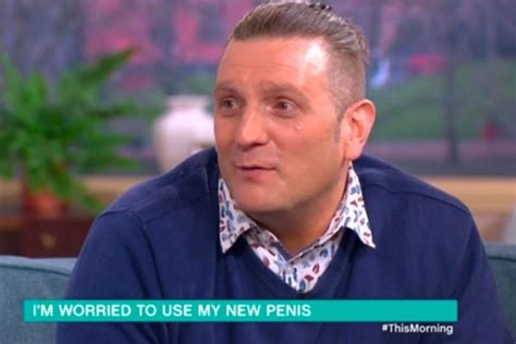 This Morning Man With Bionic Penis Opens Up On Losing His Virginity