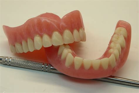 Replacement Dentures Procare Denture Clinic And Implant Centre In