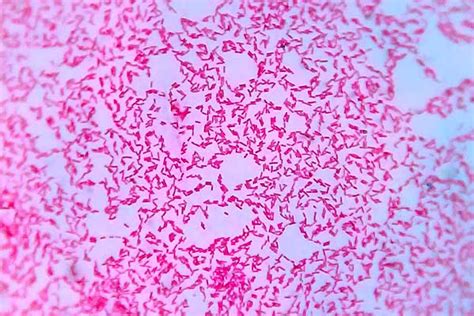 Bacterias Gram Negativas Características Estructura Enfermedades