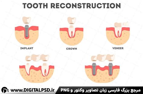 دانلود وکتور لایه باز دندانپزشکی دیجیتال پی اس دی DigitalPSD