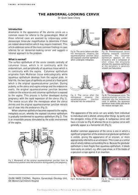 The Abnormal Looking Cervix