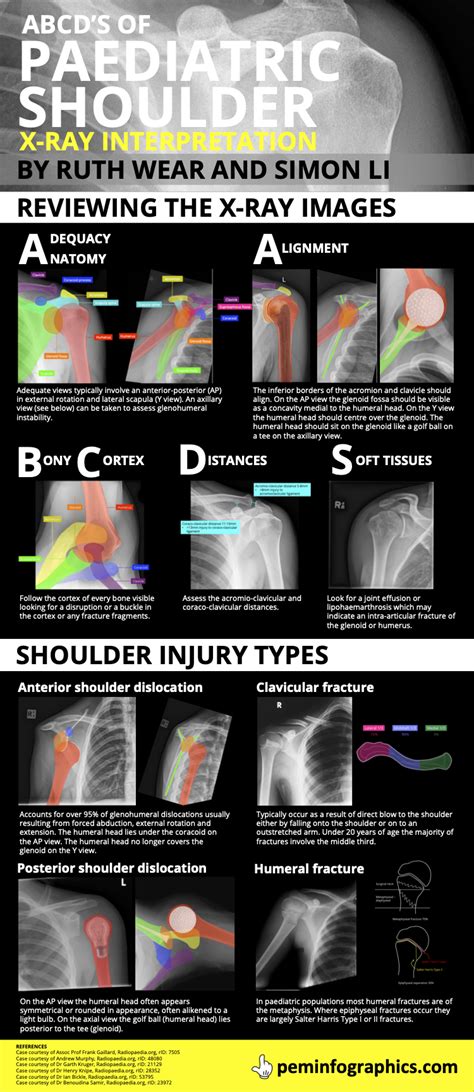 Shoulder X Ray And Interpretation Pem Infographics