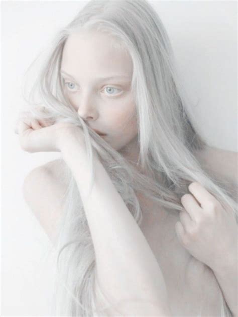Inevitables Cosas Que Te Han Sucedido Por Tener La Piel Muy Blanca Modelo Albino Personas