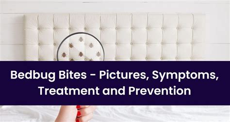 Bedbug Bites Pictures Causes Symptoms Treatment And Prevention