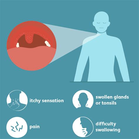 Sore Throat Signs Symptoms And Complications