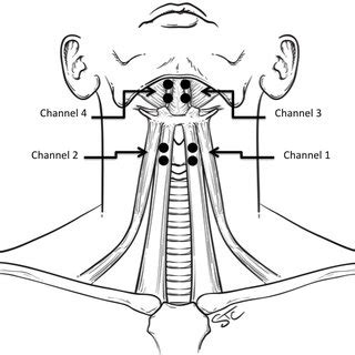 The muscular system consists of various types of muscle that each play a crucial role in the function of the body. (PDF) Non-invasive ambulatory monitoring of complex sEMG ...