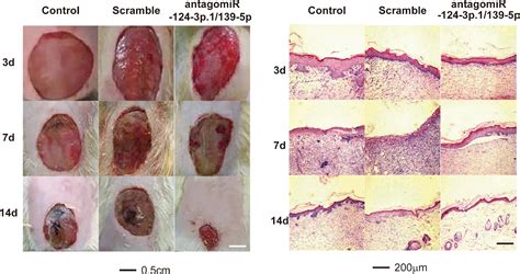 Porcine Acellular Dermal Matrix Accelerates Wound Healing Through Mir