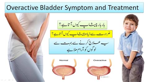 Overactive Bladder Causes Symptom And Treatment Bar Bar Peshab Ana Youtube