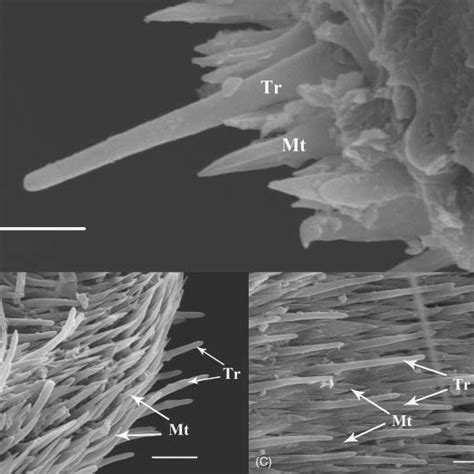 Scanning Electron Micrographs Of Trichoid Sensilla On The Antennal Download Scientific Diagram