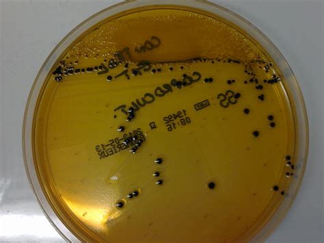 It is particularly useful for the isolation of organisms that cause bacillary dysentery, salmonella strains that cause food poisoning and salmonella paratyphi. Salmonella spp on SS Agar (Salmonella Shigella Agar) | Flickr