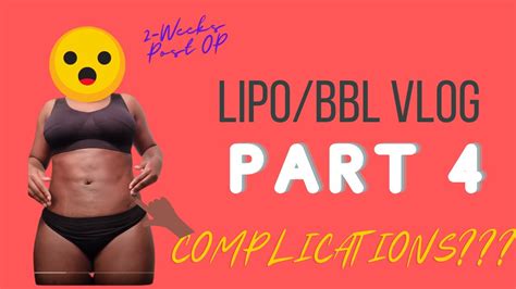 Bbllipo Vlog Part 4 2 Weeks Post Op Complications Youtube