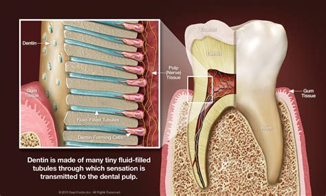 Treatment Of Tooth Sensitivity