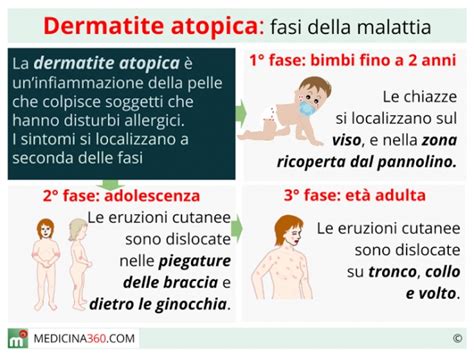 Dermatite Atopica Cause Cura Alimentazione E Rimedi Naturali