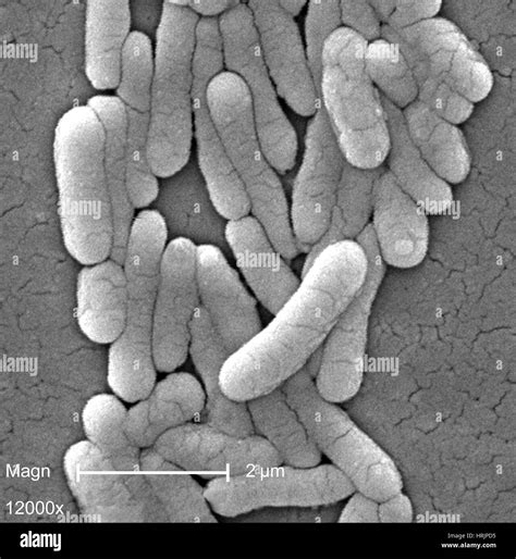 Salmonella Typhimurium Bacteria Sem Stock Photo 135022417 Alamy
