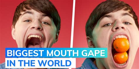 Us Teen Breaks His Own Guinness World Record Biggest Mouth Gape In The