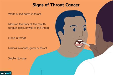 Signs Of Throat Cancer To Watch Out For 2022