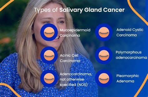 Salivary Gland Cancer Everything You Need To Know Actc