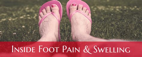 Inside Foot Pain Ankle Swelling Running Walking 7 Causes