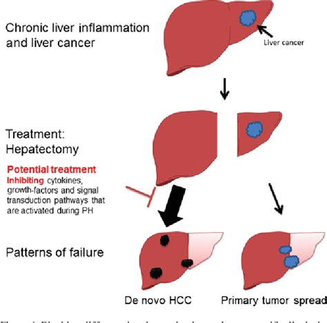 Figure 1 From Accelerated Carcinogenesis Following Liver Resection In