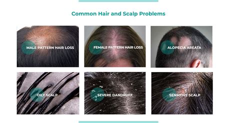 Common Hair And Scalp Problems Examples And Solutions Hair Doc