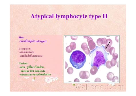Atypical Lymphocyte Lymphocytes Blood Film Medschool Steiner