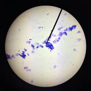 Human cheek cell has got a nucleus, rbc doesnot human cheek cell is found in the cheeks n made there a human cheek cell is thin, flat and irregularly shaped and has a large nucleus that contains the dna. Cell-fie! Cheek Cell Lab | Gracyn's Blog