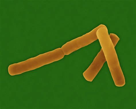 Bacillus Cereus Photograph By Dennis Kunkel Microscopy Science Photo