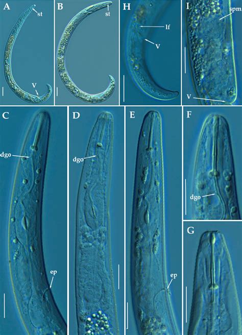 Light Photomicrographs Of Female Of Paratylenchus Veruculatus Wu 1962