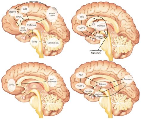 1 Brain Mechanisms In Conduct Disorder Cd And Attention