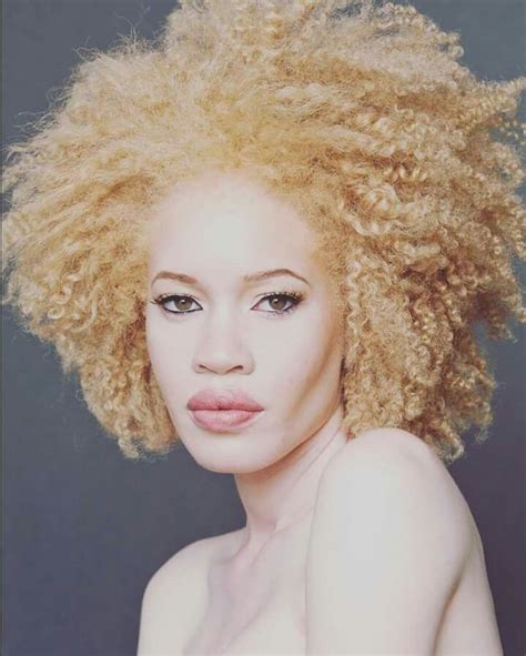 Black Albino Beauty Albino Model Black Women Hairstyles Womens