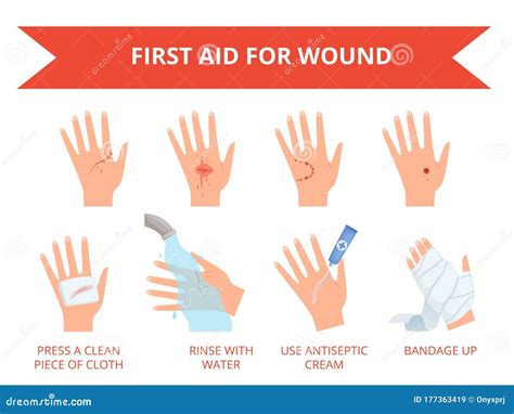 First Aid For Wound On Treatment Procedure For Bleeding Bandage On