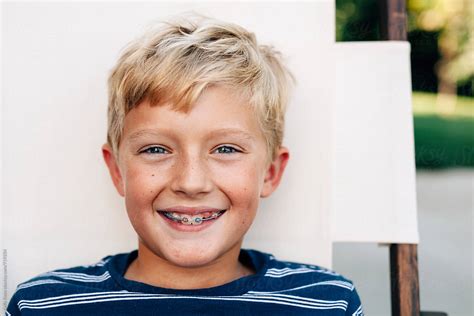 Portrait Of A Smiling Happy Boy With Braces By Stocksy Contributor