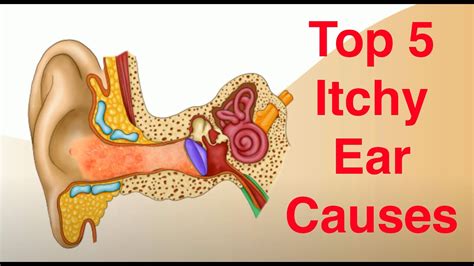 top 5 causes of itchy ears and treatment too youtube