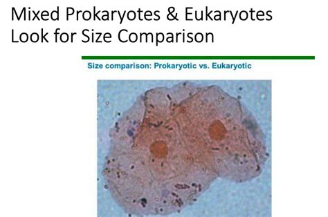 Solved Observe The Mixed Prokaryotes And Eukaryotes Slide