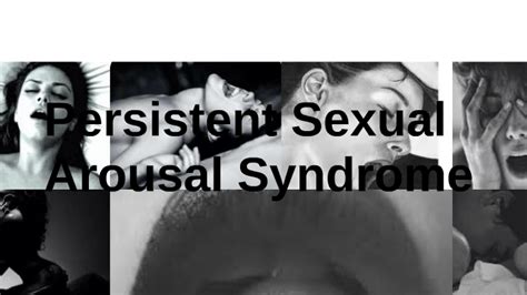 Persistent Sexual Arousal Syndrome By Francisca Perez