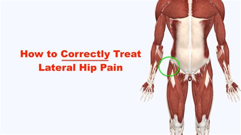 Fixing Lateral Hip Pain Squat University