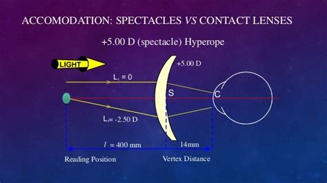 Optics Of Contact Lenses