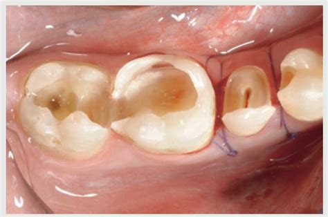 Simple Science: How to Make a Volcano with Kids