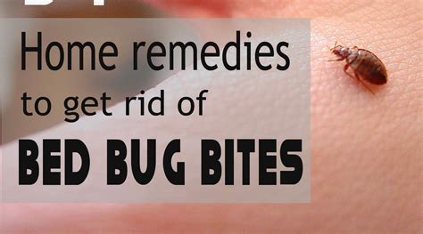 How To Treat Bed Bug Bites Guide At How To