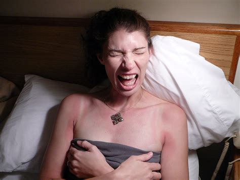 Sunscream For Sunburn Erica Flickr