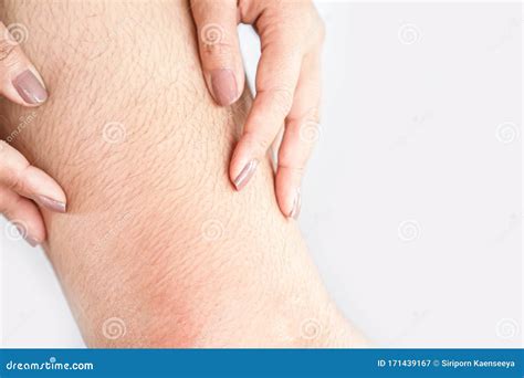 Closeup Woman With Hairy Unshaven Hair Leg Stock Image Image Of Hand Femininity 171439167