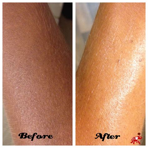 Save Your Spray Tan With Coconut Oil