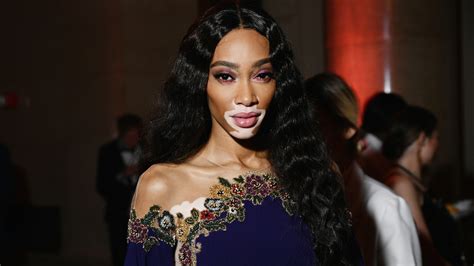 Winnie Harlow Makes History As Sports Illustrateds First