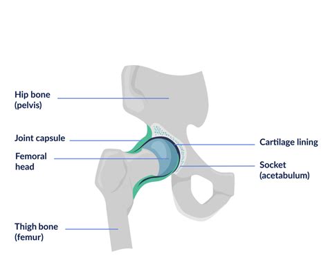 Anatomy Osteoarthritis And Total Hip Replacement Surgery Support