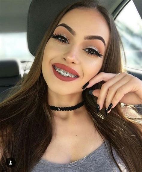 Cute Girl Braces For Teeth Telegraph