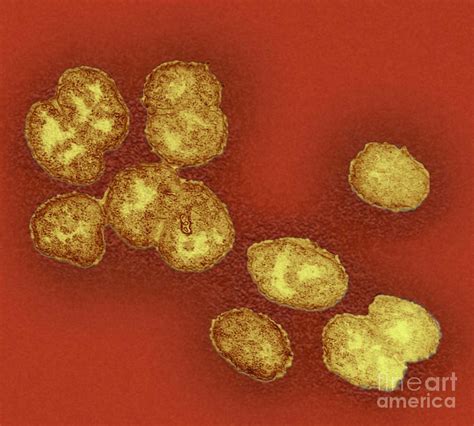 Gonorrhoea Bacteria Photograph By Ami Imagesscience Photo Library