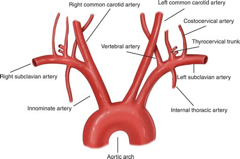 Arteries simple diagram (page 1). Acute Subclavian Artery Thrombosis - Hand - Orthobullets