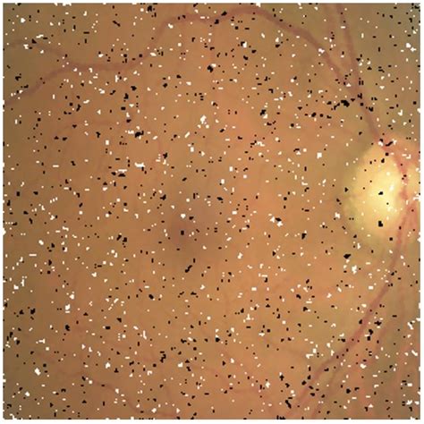 A Normal Fundus Photograph Of A Right Eye Download Scientific Diagram