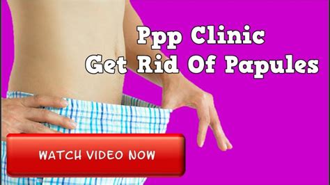 Ppp Clinic Get Rid Of Papules Ppp Removal Cream Papule Treatment