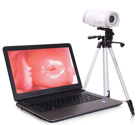Mslce Portable Colposcope Pixel Video Colposcope For Vagina China Colposcopy And